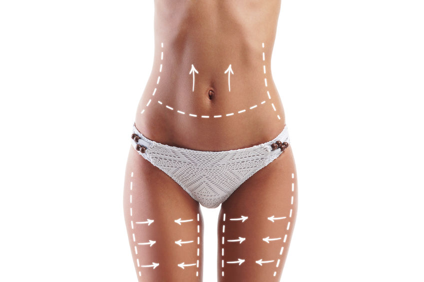 Les nouvelles techniques de liposuccion en chirurgie esthétique